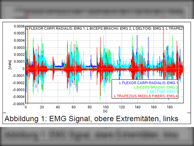 EMG