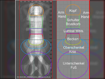 Erarbeitung von Vorschlägen zur Zonengestaltung